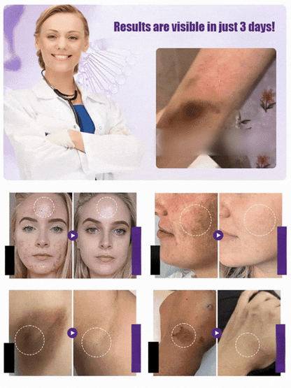 Highly effective whitening and spot-lightening cream