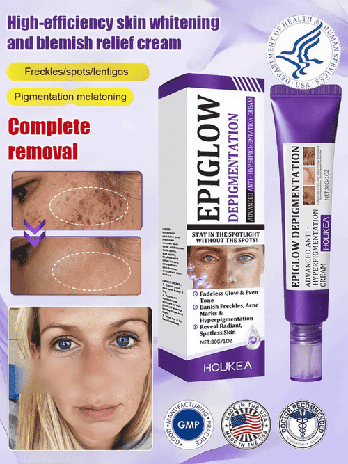Highly effective whitening and spot-lightening cream
