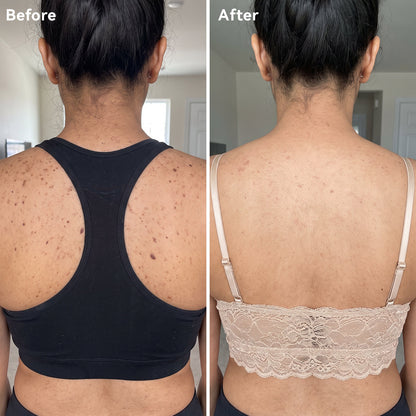 Smooth & Even Glycolic Body Stick